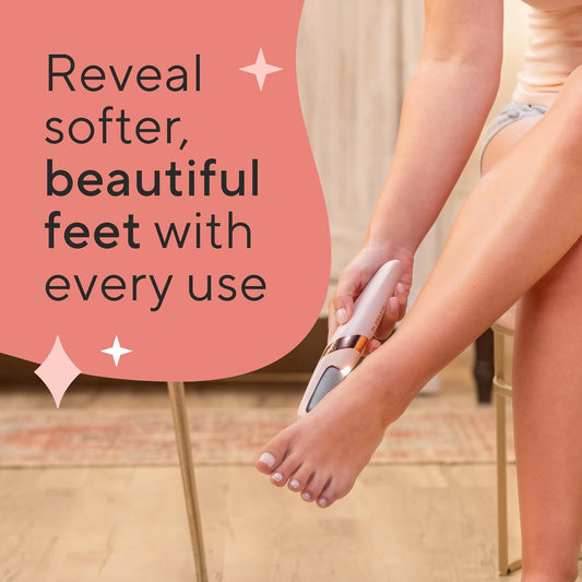 SoleGlide™ Callus Remover